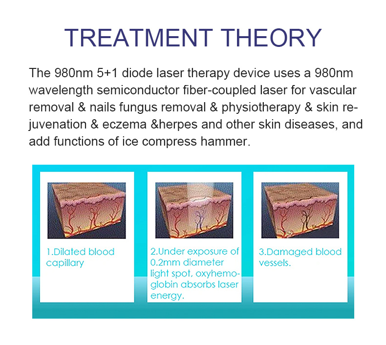 Most Effective 4 in 1 980nm Diode Laser Vascular Removal Machine Vascular Removal for Sale