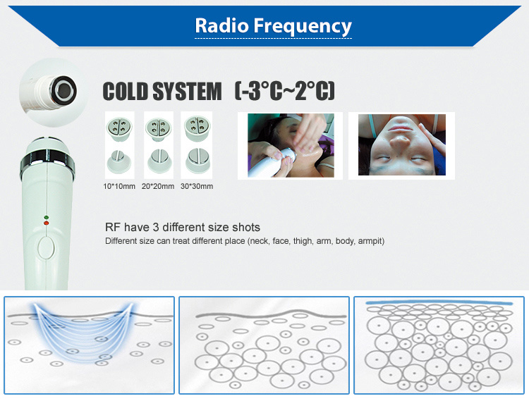 Powerful Opt IPL RF ND YAG Laser Hair Remove Machine