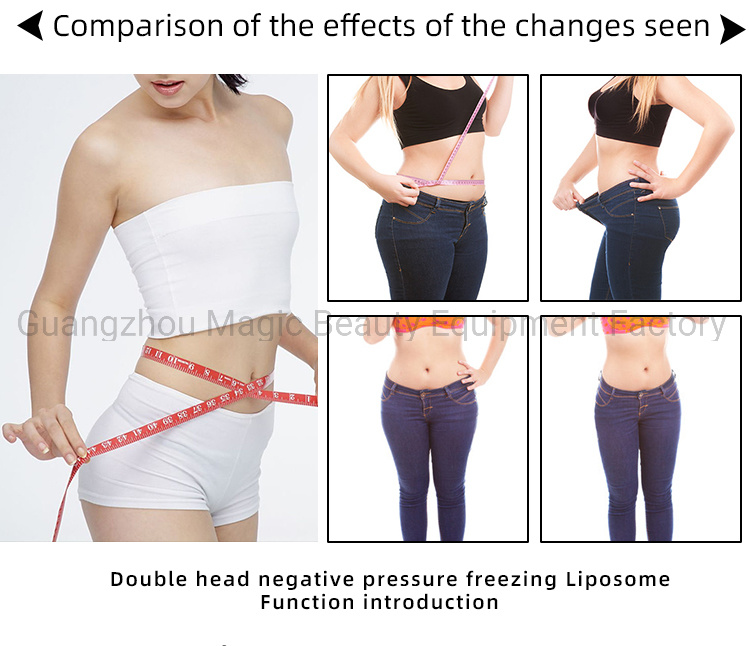 5 in 1 Cryolipolysis Machine for Body Slimming Weight Lose