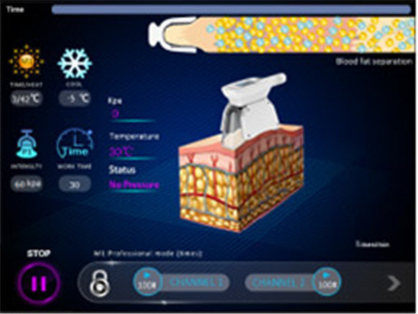 Professional Cryolipolysis Slimming Machine Vacuum Cool Tech Beauty Equipment