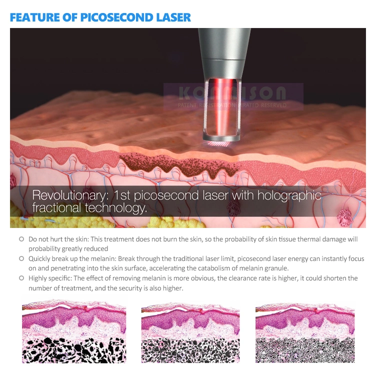 755nm 1064nm 532nm Picosecond Laser Q Switch ND YAG Laser for Tattoo Removal and Pigment Therapy
