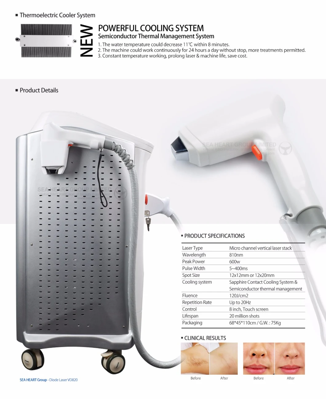 Professional 600W 755/810/1064nm Diode Laser Hair Removal
