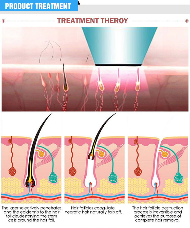 New Portable IPL Shr Hair Removal Machine/IPL RF/IPL Shr Made in China Beauty Machine