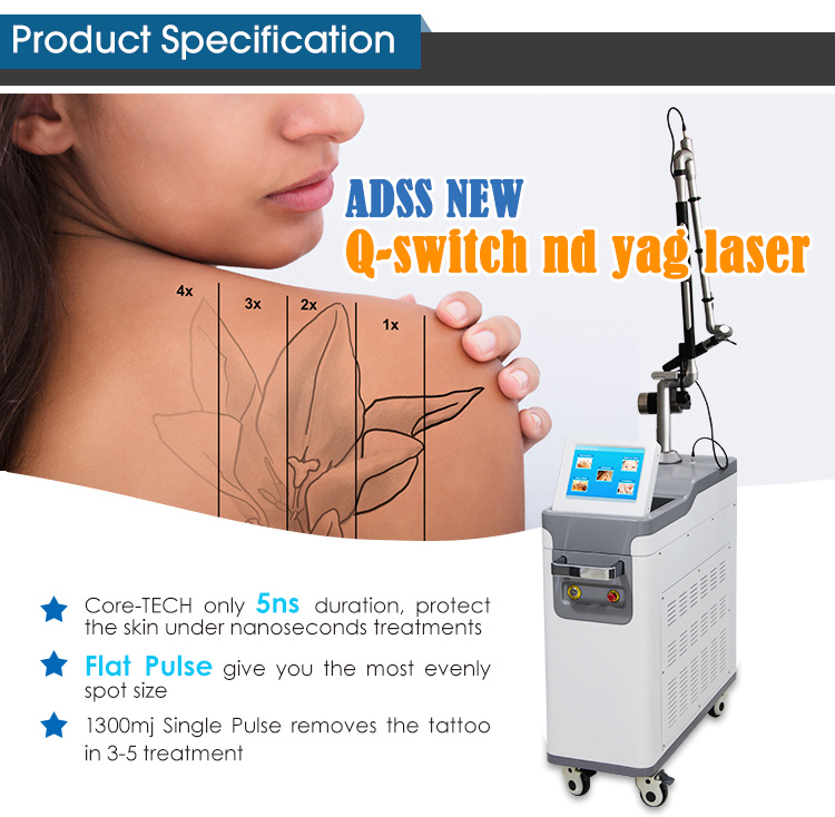 Q-Switched ND: YAG Laser Tattoo Removal Machine Laser ND: YAG,