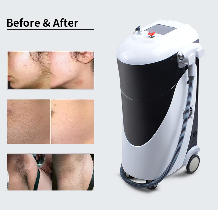 Powerful Permanent 808nm Diode Laser Hair Removal Beauty Machine Painless Salon Beauty Equipment