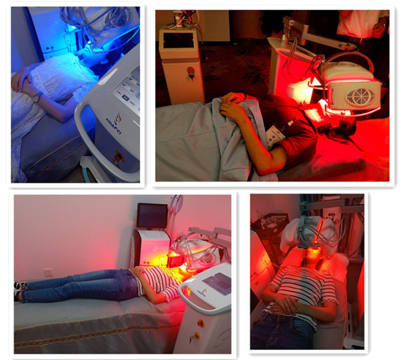 LED PDT Light Phototherapy Beauty Machineacne Removal LED PDT Skin Beauty