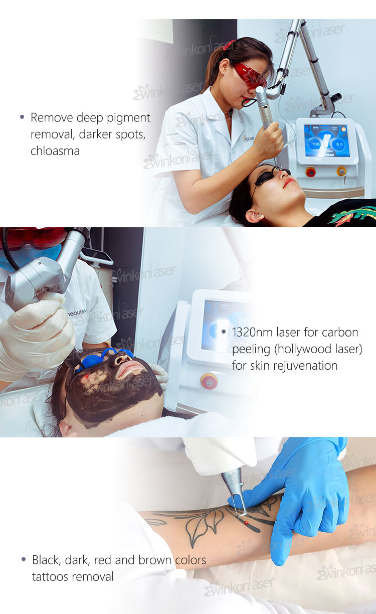 Skin Treatment Skin Rejuvenation Picosecond Laser for Refractory Pigmented