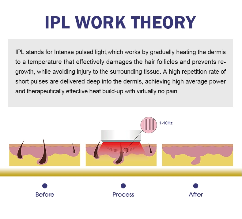 Elight IPL Hair Removal/Electrolysis Hair Removal Machine/IPL Laser