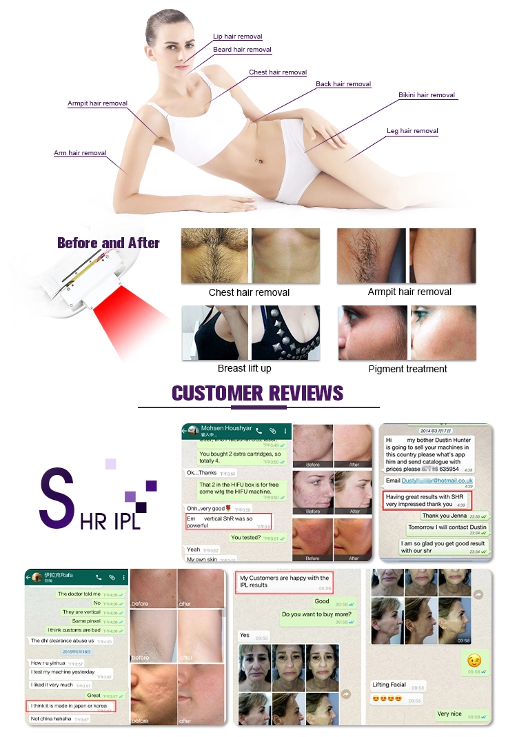 Vertical Shr Laser IPL, IPL Machine, Shr IPL Hair Removal