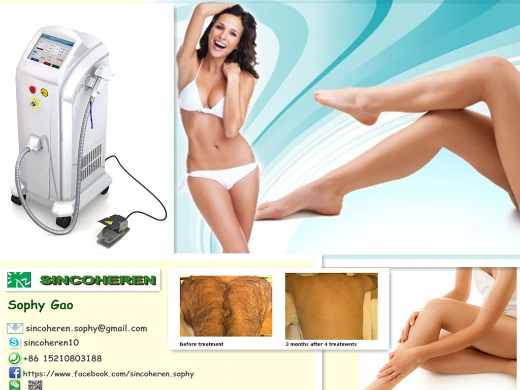2015 Beijing Sincoheren Latest Hair Removal Machine Medical CE Approved Diode Laser 808