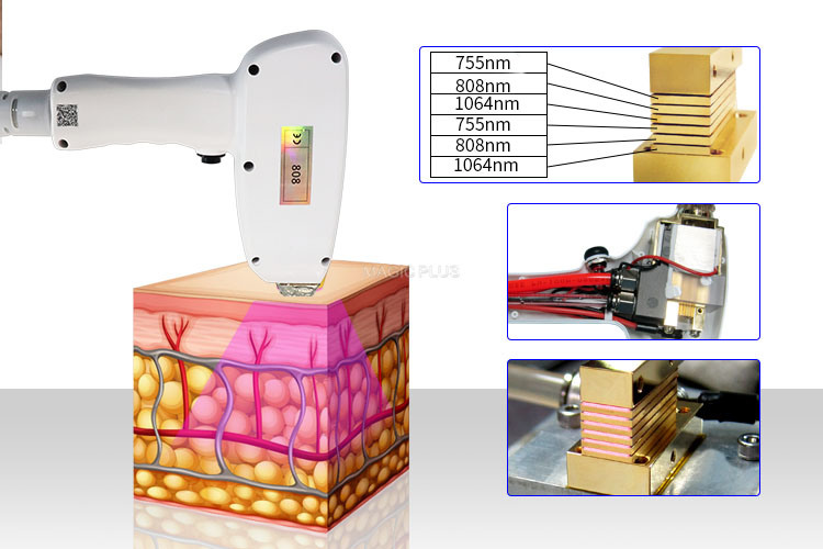 3 Wavelength 808nm and 1064nm 755nm Hair Removal Dark Skin Laser Epilation Machine