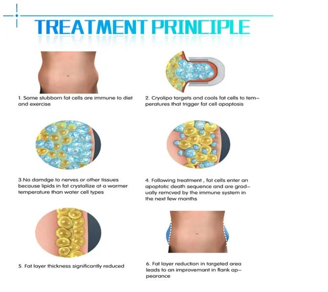 Effective Cryolipolysis+ RF + 40K Cavitation Fat Freeze Slimming Machine with Heart Rate Detection