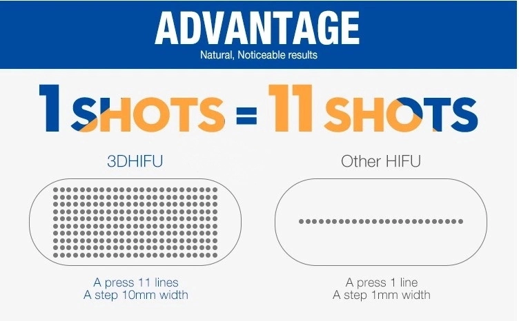 Effective Treatment Result 3D Hifu Face and Body Equipment for Face Life /Body Slimming