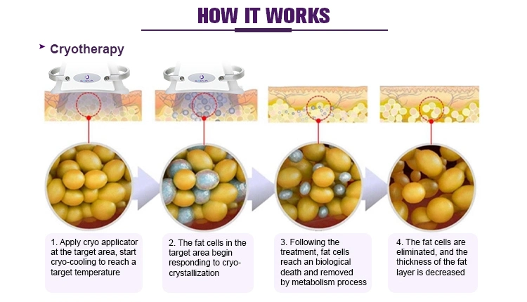 Lipolaser + cavitazione + corpo di Cryo di terapia di vuoto + di rf che dimagrisce macchina di dimagramento di congelamento grassa