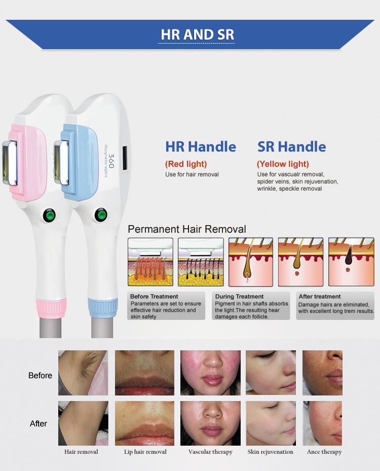 Factory Promotion Price IPL Hair Removal Beauty Machine with Double Handle