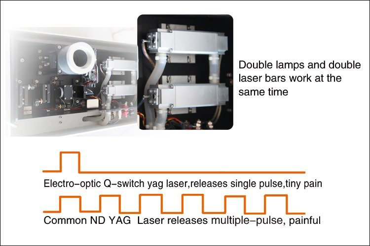 ADSS Tattoo Removal Eo Q-Switched ND YAG 1000mj ND YAG Xenon Lamp