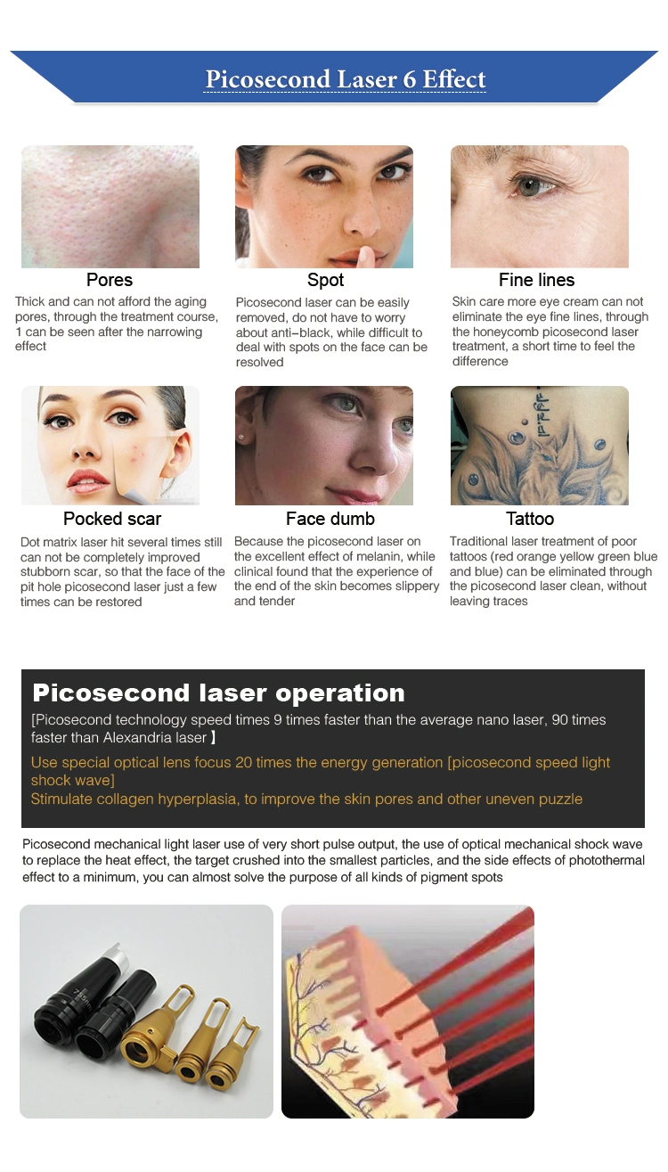 Professional Picosecond Laser Tattoo Removal Machine for Freckles Removal