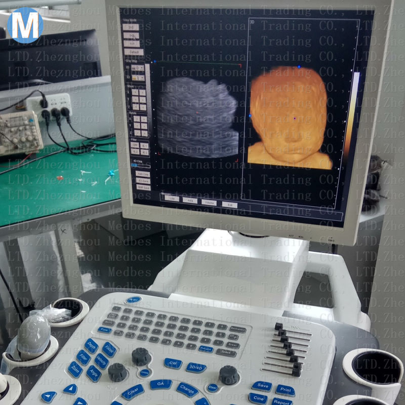 M-F30t Ultrasonic Optical Electronic Equipment