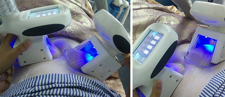 Freezing Slimming Fat Removal Ultrasonic 40K Cavitation RF Beauty Slimming Machine
