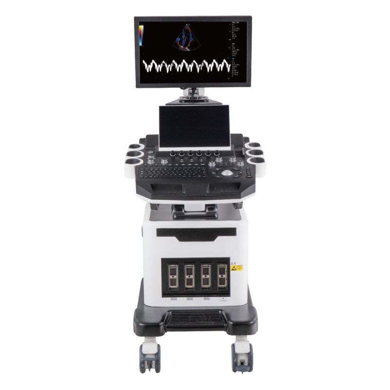 Ultrasound Trolley Trolley Ultrasound Machine Chison Ultrasound Trolley Ultrasound