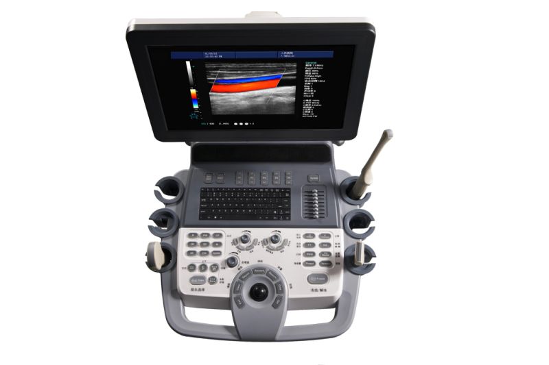 High Resolution Full Digital Trolley Color Doppler Ultrasound Machine/ Portable Ultrasound Mslcu30