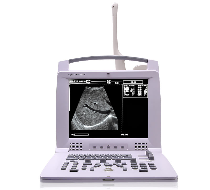 Mslpu49 Full Digital Portable Laptop Ultrasound Machine / High Resolution Ultrasound Scanner