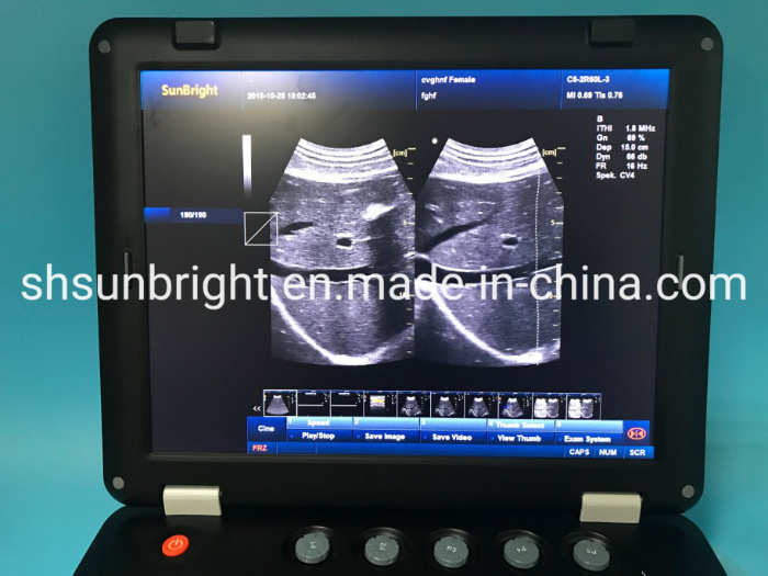 Colorful Ultrasound Scanner Doppler Color Ultrasound Sun-906A Medical Ultrasound Scan