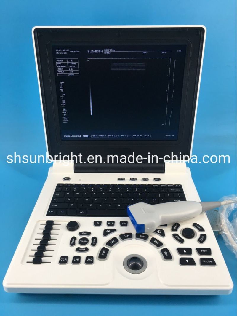 12.1 Inch High Resolution Ultrasound Scanner Sun-806h Clinic Portable Ultrasound