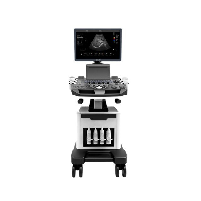4D Cart Color Ultrasound/Enhance Your Ultrasound Exam
