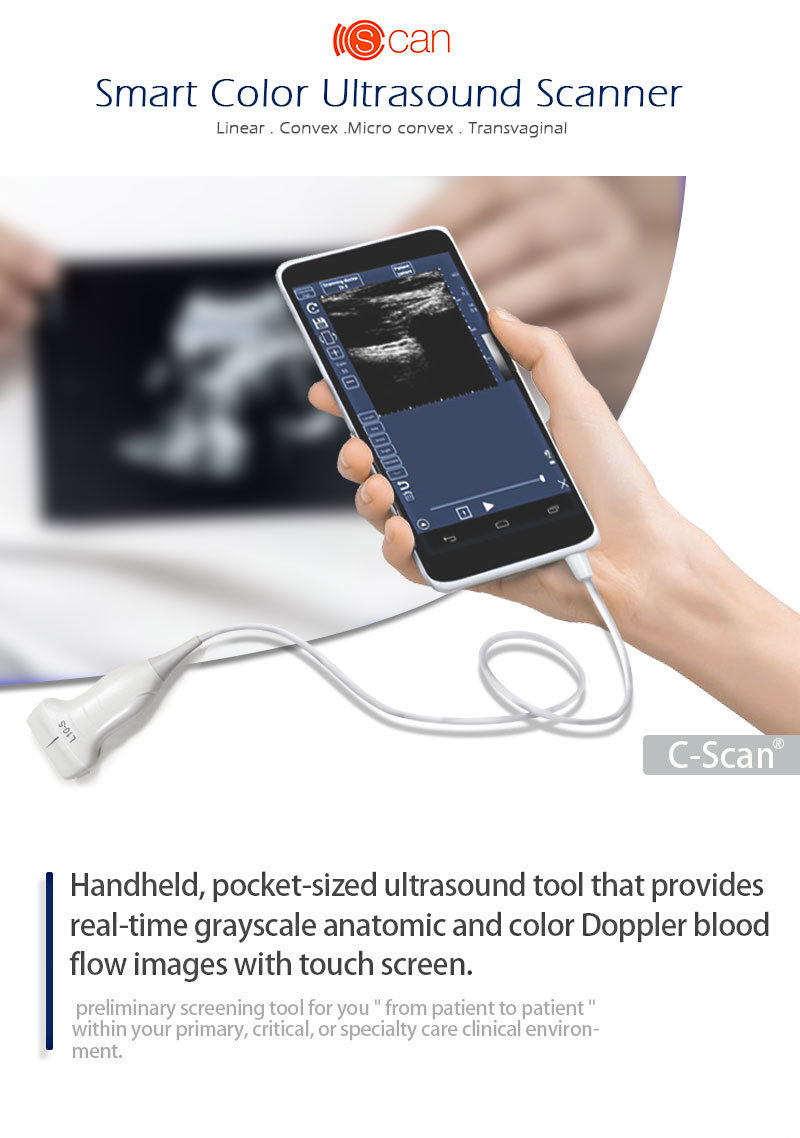 Android Portable Ultrasound Scanner, Color Ultrasound and Handheld Size