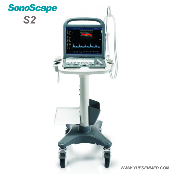 Medical Mobile and Portable Sonoscape 3D 4D Color Doppler Machine