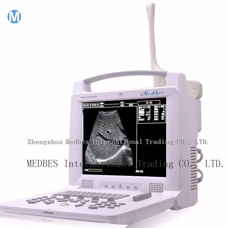 B-Ultrasound Diagnostic System 3D B W Cheapest Ultrasound