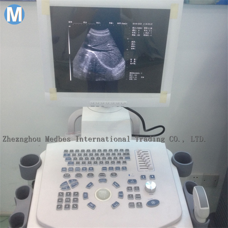 China Ultrasound Scanner Manufacturer Trolley