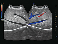 China Top Medical Device Ultrasound Portable Ultrasound Scanner