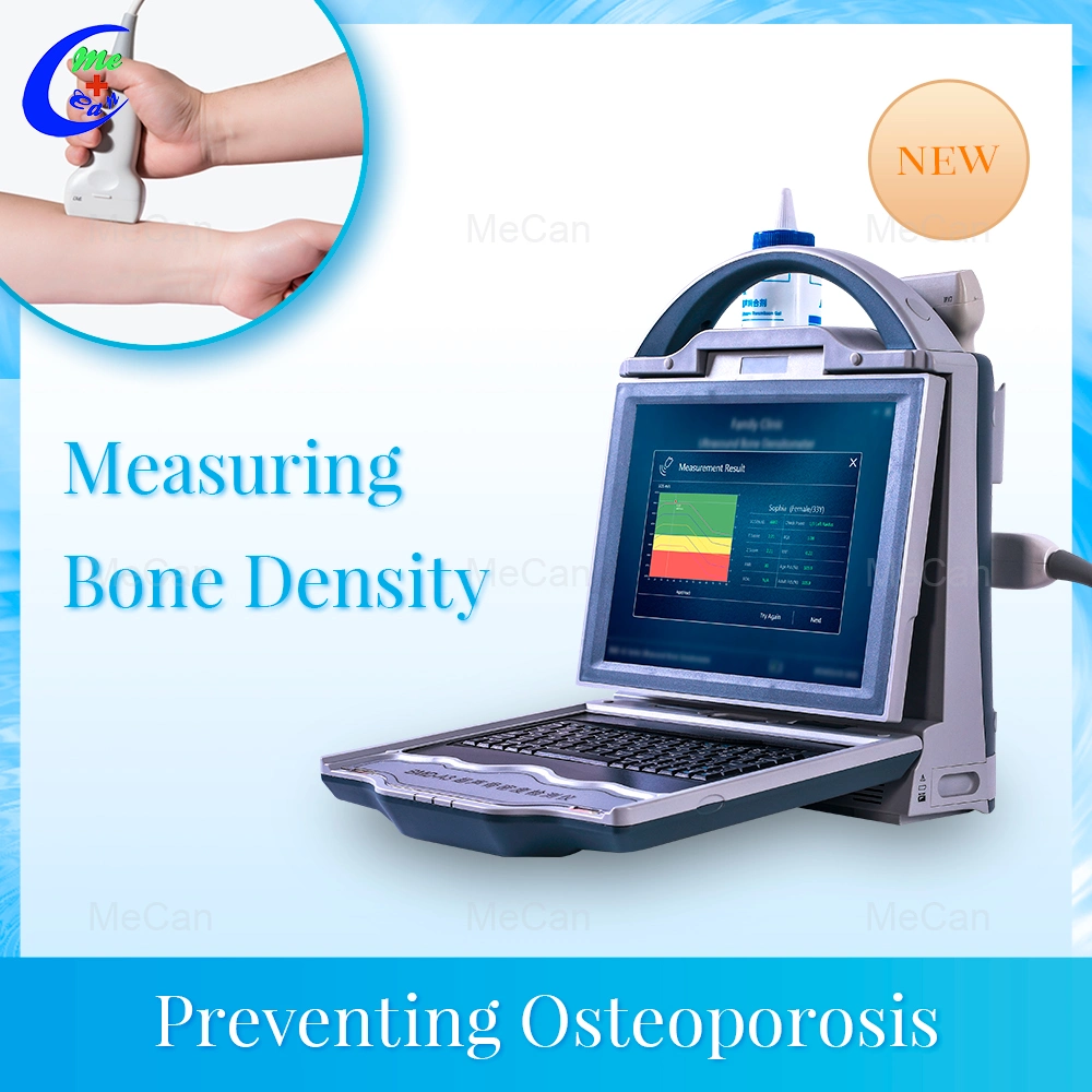 Automatic Portable High Effective Ultrasound Bone Densitometer MCU-Bda3