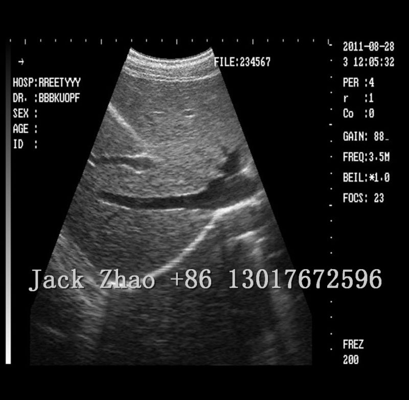 Laptop B/W Diagnostic Ultrasound System M-B150