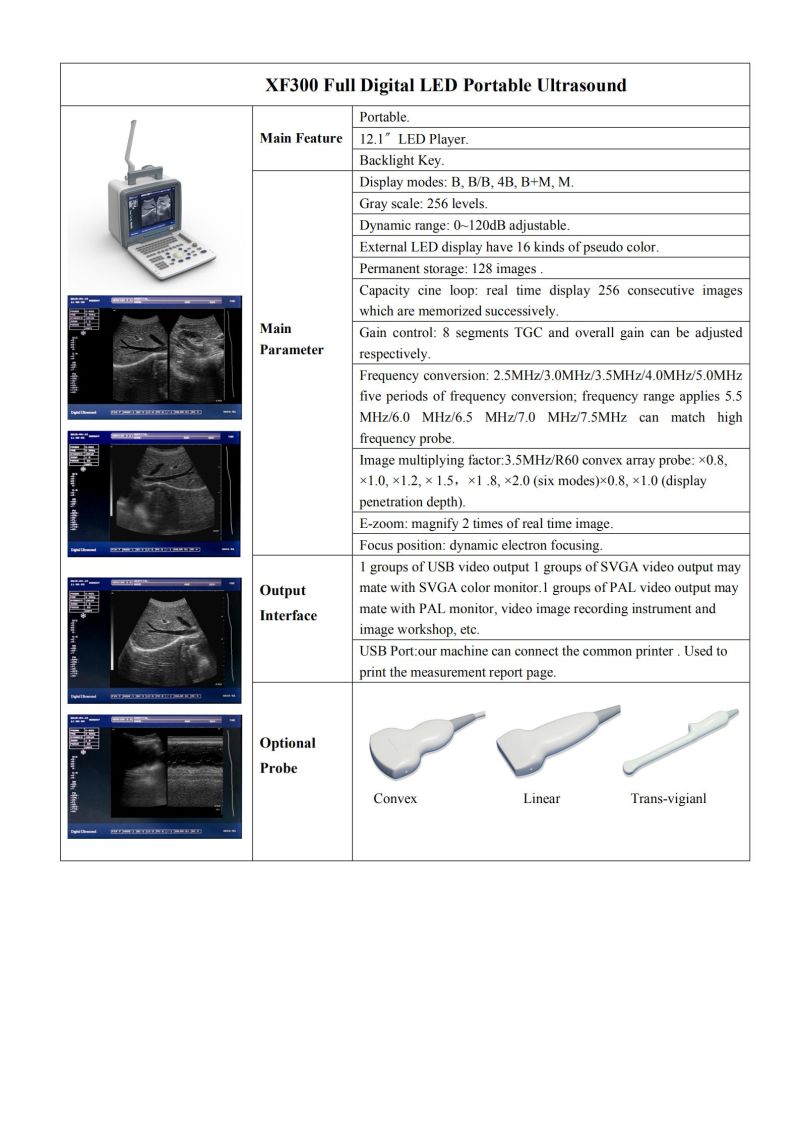 Cheapest Portable Ultrasound Scanner / Laptop Mobile Ultrasound