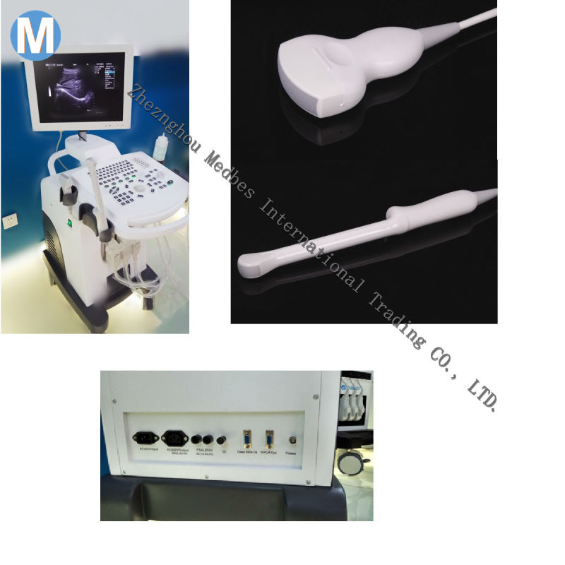 China Ultrasound Scanner Manufacturer Trolley