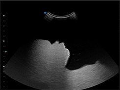 China Top Medical Device Ultrasound Portable Ultrasound Scanner