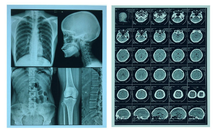 Medical Radiology Professionals Laser Images Film