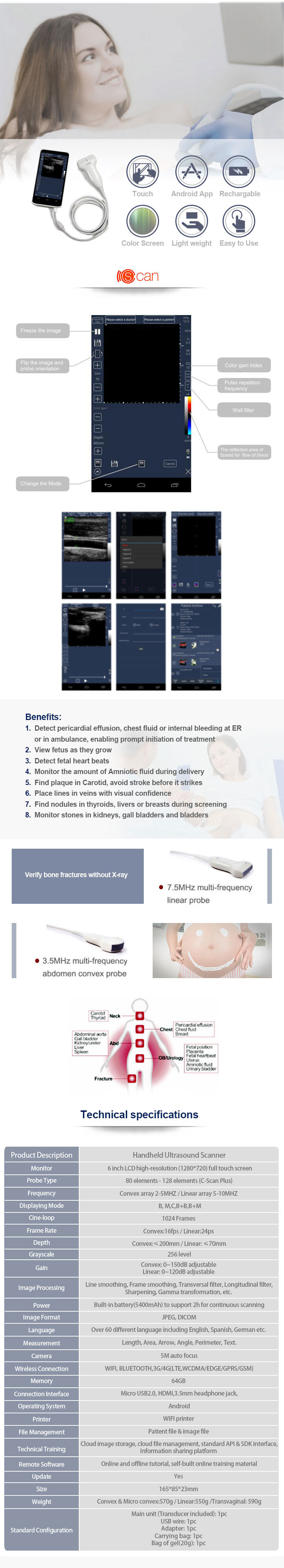 Smart Ultrasound, Android Portable Ultrasound Scanner/Handheld Color Ultrasound
