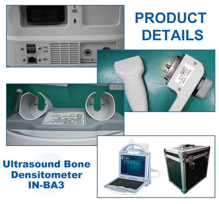 IN-BA3 Portable Laptop Digital Automatic Ultrasound Bone Densitometer