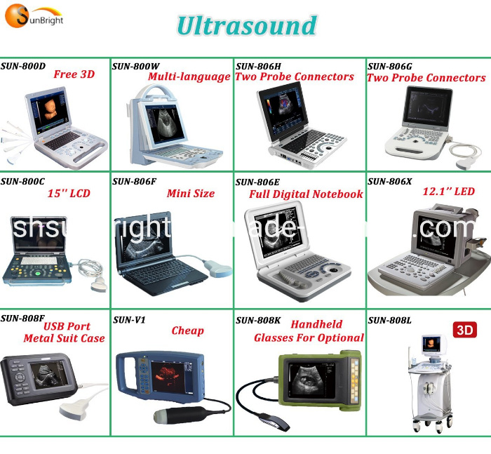 Sun-808f Cheap Price Ultrasound Machine Ultrasound Vet Rectal Probe Ultrasound Cattle