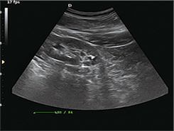 China Top Medical Device Ultrasound Portable Ultrasound Scanner