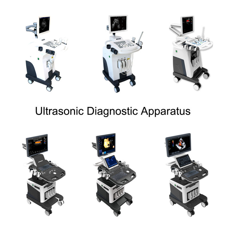 China Top Medical Device Ultrasound Portable Ultrasound Scanner