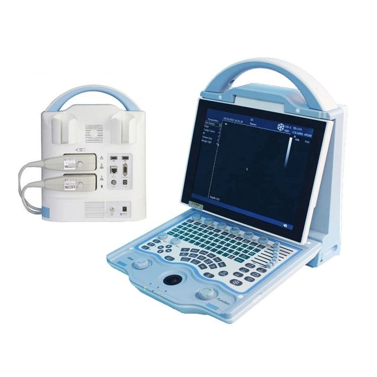 Laptop Ultrasound Scanner Ultrasound Bone Densitometer Yj-U5600