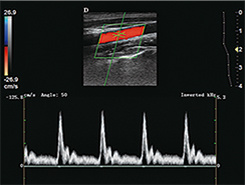 China Top Medical Device Ultrasound Portable Ultrasound Scanner