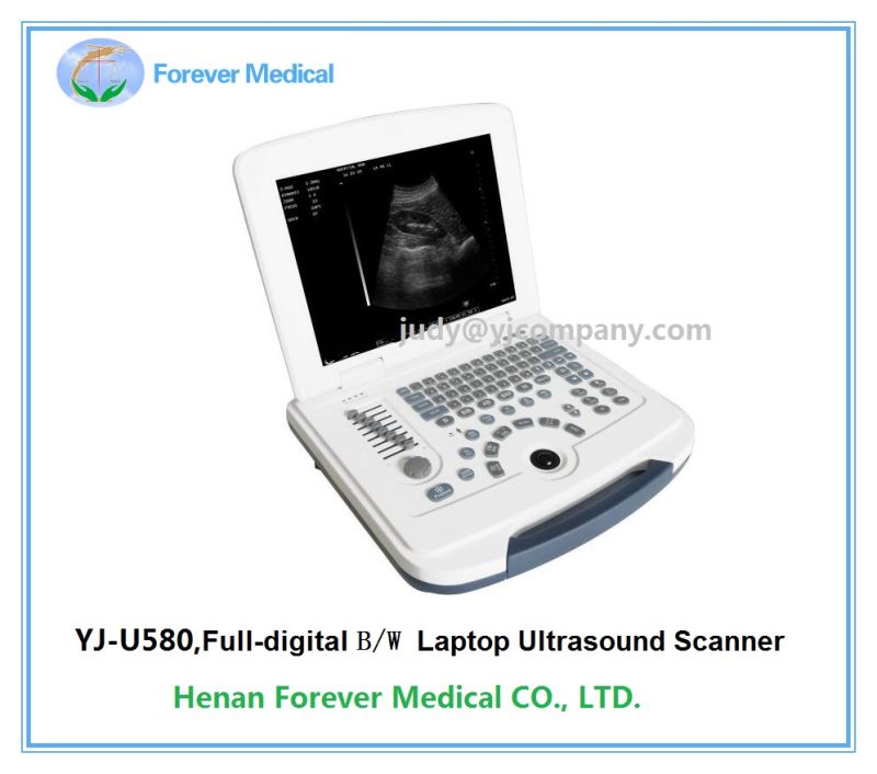 Laptop Ultrasound Scanner Ultrasound Bone Densitometer