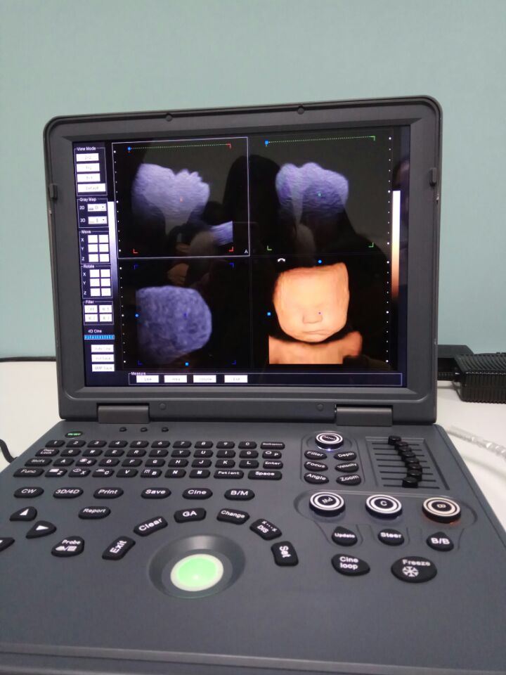 Portable Ultrasound Doppler Ultrasound Ultrasound Laptop Portable Ultrasound Machine Dopple