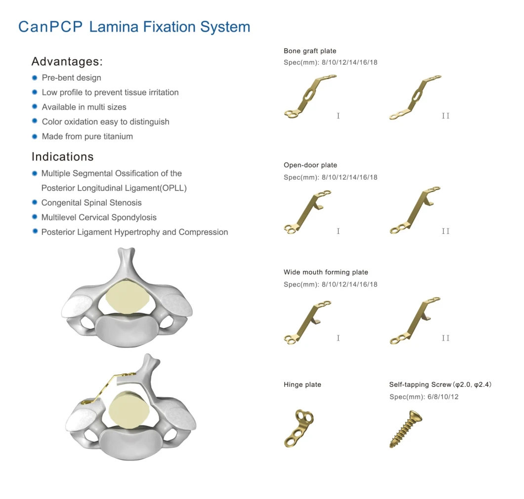 Canwell Laminoplasty Fixation System Spine Implants Bone Graft Plates